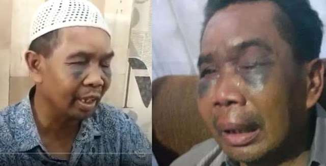 otto-hasibuan-pertanyakan-penahanan-djoko-tjandra-oleh-polisi