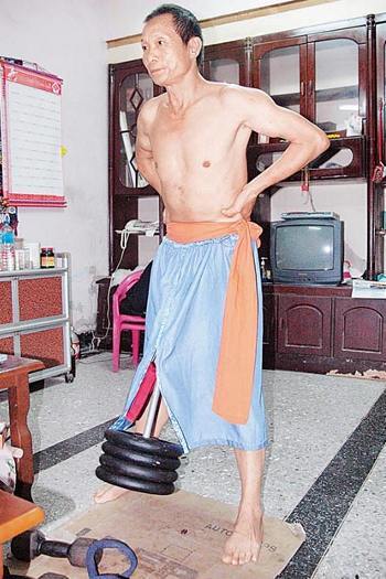 5 Kelainan Alat Vital Pria Paling Hot
