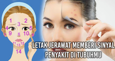 Letak Jerawat di Muka Bisa Jadi Pertanda Penyakit ini lo.