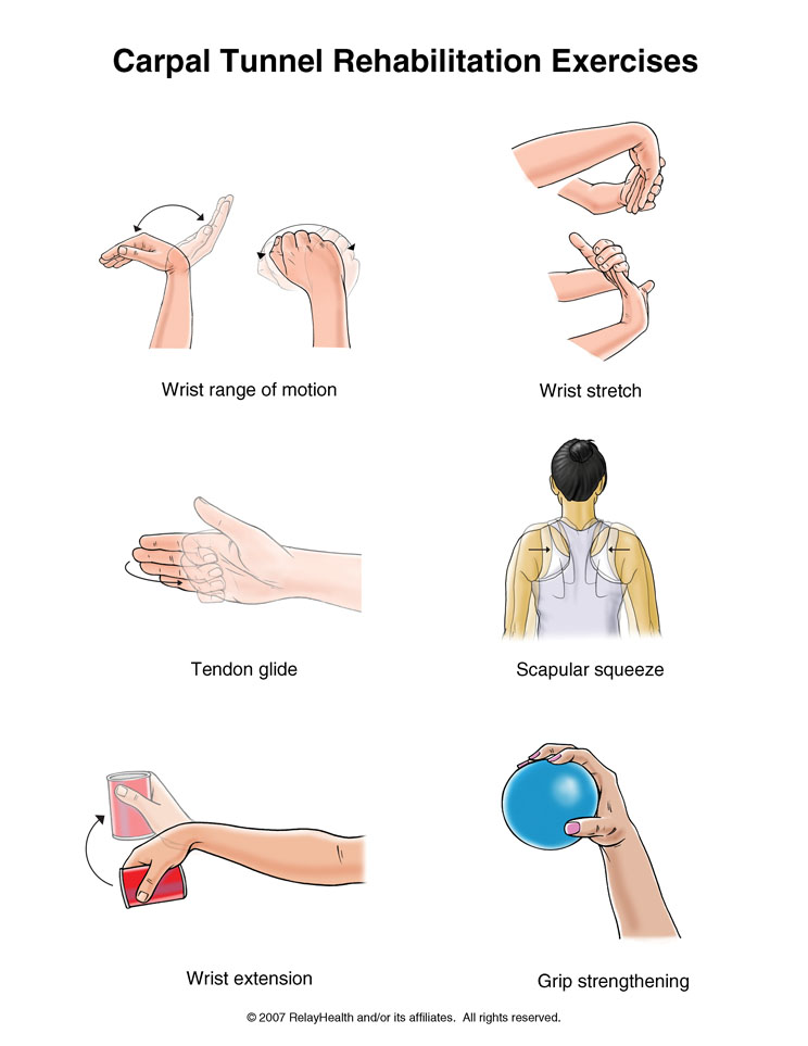 Terapi Carpal Tunnel Syndrom (CTS)