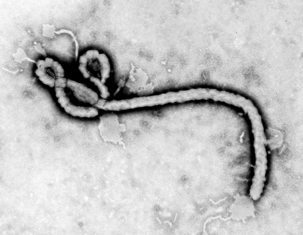 8 Virus Paling Berbahaya Di Dunia
