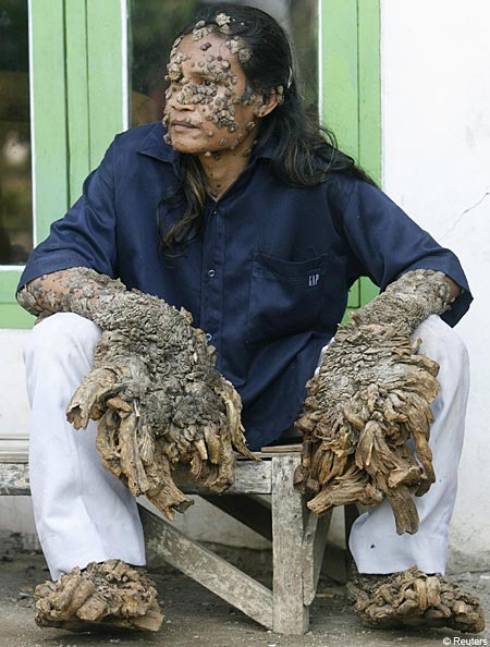 HEBOH, Manusia Paling Aneh dari Asia yang Hebohkan Dunia !