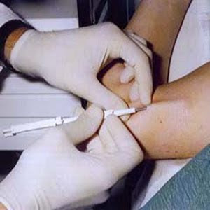 Mengenal Berbagai Macam Alat Kontrasepsi 