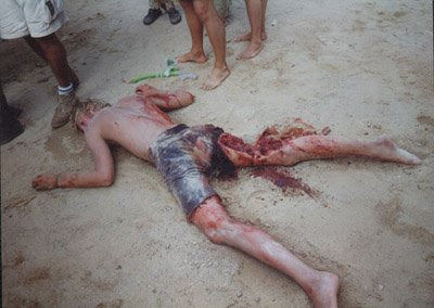 Foto korban keganasan ikan hiu, ngeri!!