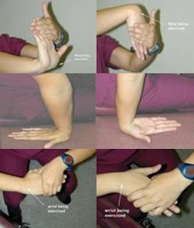 Terapi Carpal Tunnel Syndrom (CTS)