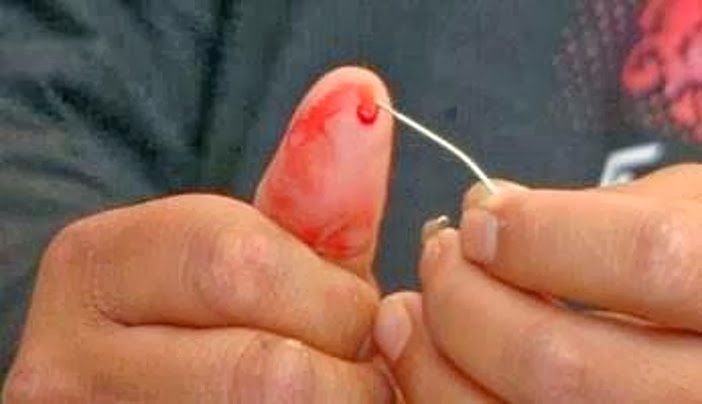 Petolongan Pertama Stroke Tusuk Jari Hoax