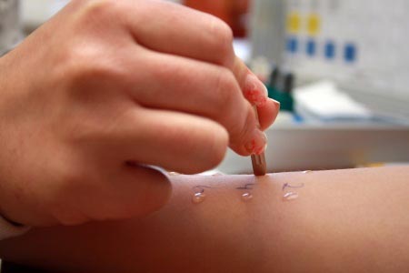Skin Prick Test, Tes Alergi Kulit Terbaik