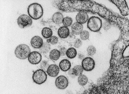 8 Virus Paling Berbahaya Di Dunia