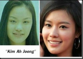 15 Artis Korea yang melakukan operasi plastik -