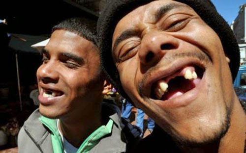 Afrika Selatan lagi Tren Gigi Opong