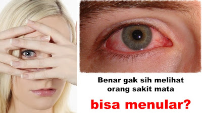 sakit-mata-menular-melalui-tatapan-mata-benarkah-demikian