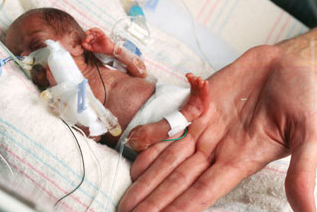 10 Bayi Paling Aneh Yang Pernah Terlahir di Dunia