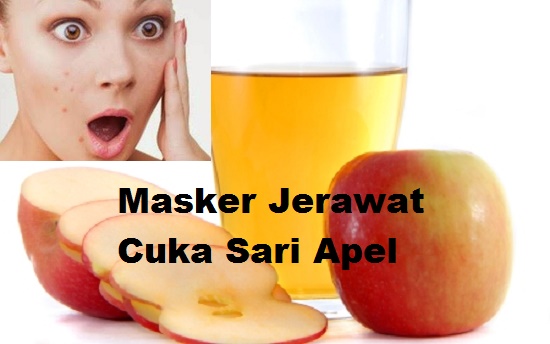 Jerawat Muncul Saat Haid? Tangani Disini Yuk Sis!