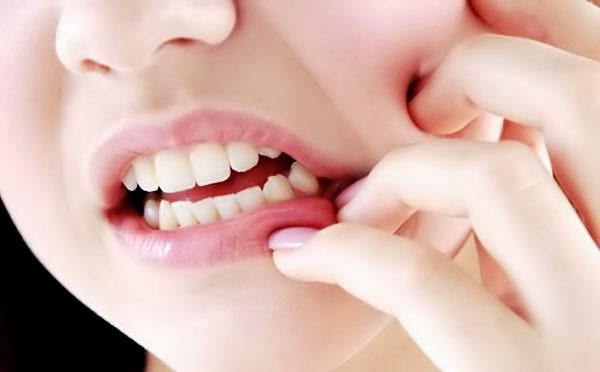 Lima Tips Meredakan Sakit Gigi Secara Alami
