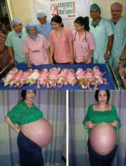 Ibu asal India melahirkan 11 bayi