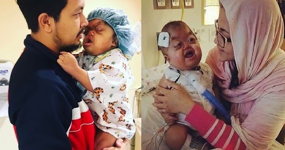 MASYA ALLAH ! Kesabaran Suami Istri Rupawan dan Anaknya yang Tuli &amp; Buta