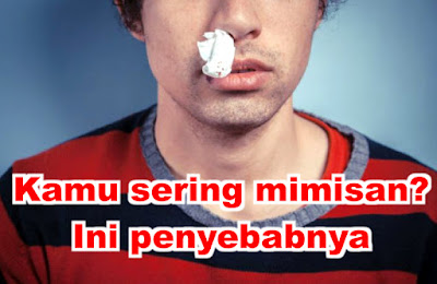 agan---sista-sering-mimisan-ini-penyebabnya-utamanya