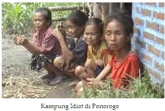4 Hal Yang Membuat Orang Menjadi Gila