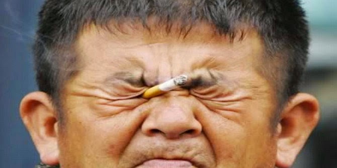 5 orang yang memiliki keunikan pada organ penglihatannya