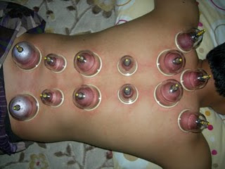 8-akibatnya-agan-kebanyakan-tidur