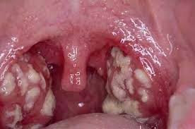 ini-sederet-masalah-kesehatan-mulut-yang-mungkin-tidak-anda-ketahui