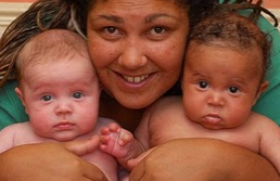 10 Bayi Paling Aneh Yang Pernah Terlahir di Dunia