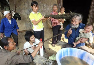 Pria Yang Tidak Pernah Mencuci Rambutnya Selama 26 Tahun...