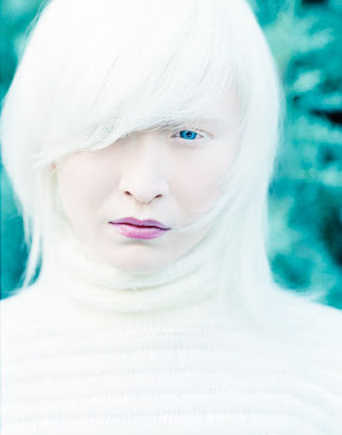 connie-chiu-model-albino-dari-cina