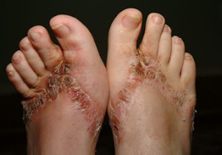 Bahaya Sandal Gan