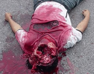 Ekspresi Korban Kepala Pecah dari berbagai Kejadian :D