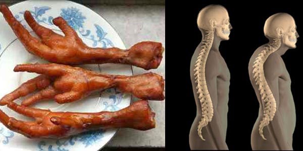 Efek Mengkonsumsi Ceker Ayam