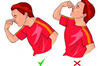 Agan / sista sering mimisan? Ini penyebabnya utamanya