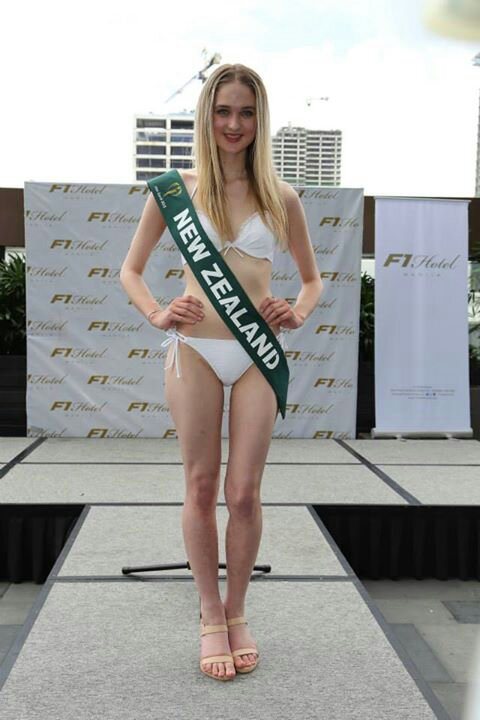 10 Foto Model Ini Lain Dari Model-Model yang Biasa Kamu Lihat di TV dan Majalah