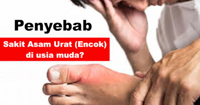 Waspadalah!! Ini Penyebab asam urat di usia muda