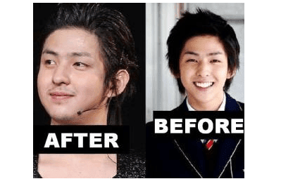 5 Artis Korea Paling Tampan Karena Operasi Plastik