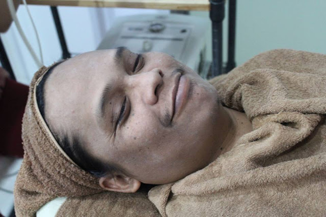 Aw Aw Aw! Perawatan Kulit Agan di Lineation Centre
