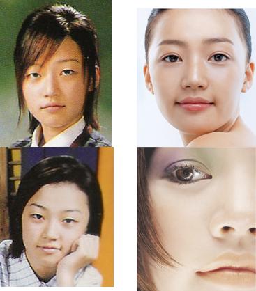 10 Foto Aktris Korea Sebelum dan Sesudah Operasi Plastik