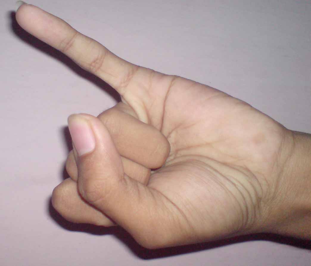 Alat-alat yang Sering digunakan untuk Ngorek Telinga