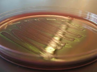 Ada Bakteri Yang Bisa Menghasilkan Bensin