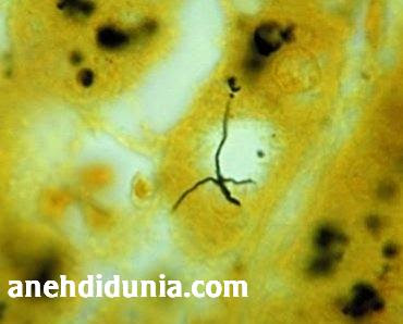&#91; HOT INFO..!!!! &#93;Bahaya Penyakit Leptospirosis Akibat Banjir