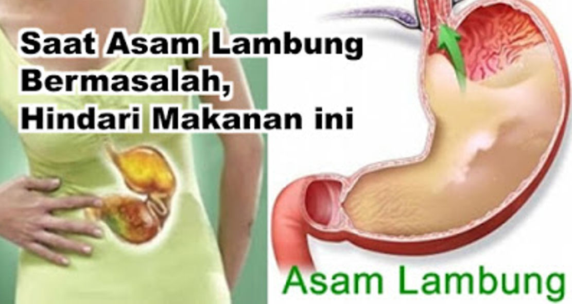 hindari-makanan-ini-kalau-kamu-penderita-asam-lambung