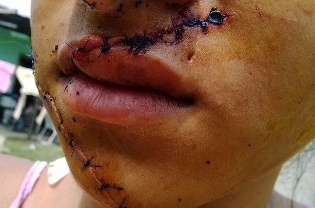 Tidak Selamanya Cantik Itu Beruntung, Nyatanya Kecantikan Bisa Mendatangkan Petaka