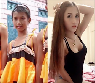Transgender dalam segi medis