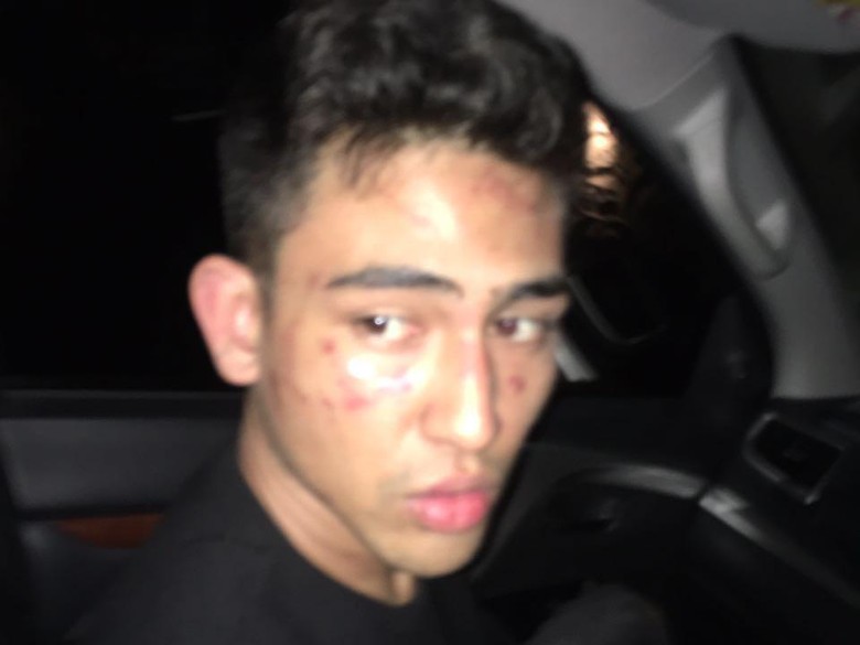Murka Anaknya Disiksa Oknum Polisi, Jeremy Thomas: Ini Brutal dan Maniak!