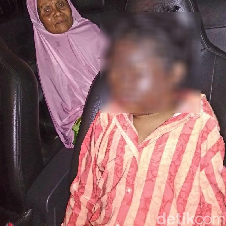 Duh, Nenek Ceburkan Wajah Cucu Perempuannya ke Minyak Panas