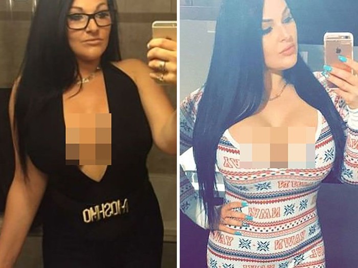 waduh-wanita-amerika-ini-operasi-plastik-rp-700-juta-demi-mirip-bintang-porno