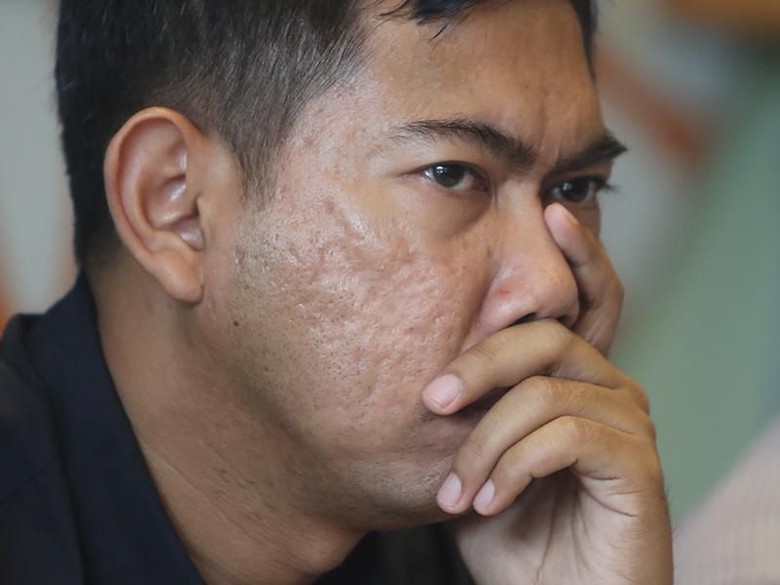 Ahli: Perbaikan Gugatan Hasil Pilpres Bertentangan dengan Hukum Acara MK