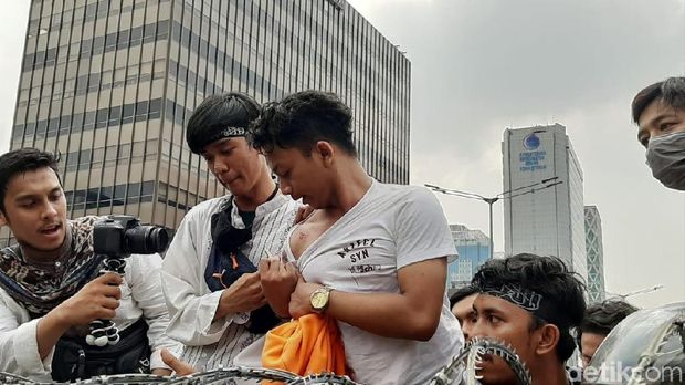 Ngaku Ditembak, Pendemo Ini Tunjukkan Luka di Dada dan Selongsong Peluru