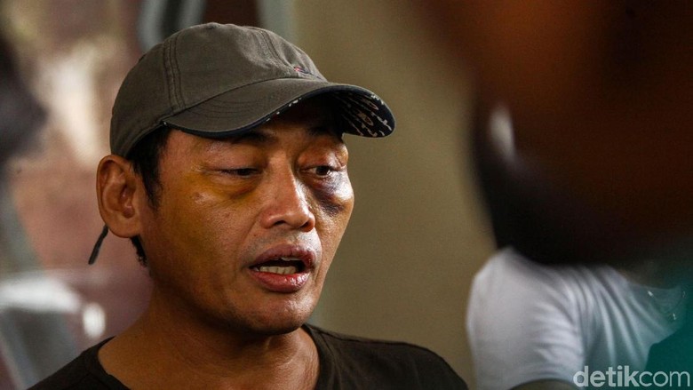 total-ada-3-tersangka-perempuan-di-penculikan-ninoy-karundeng-ini-perannya