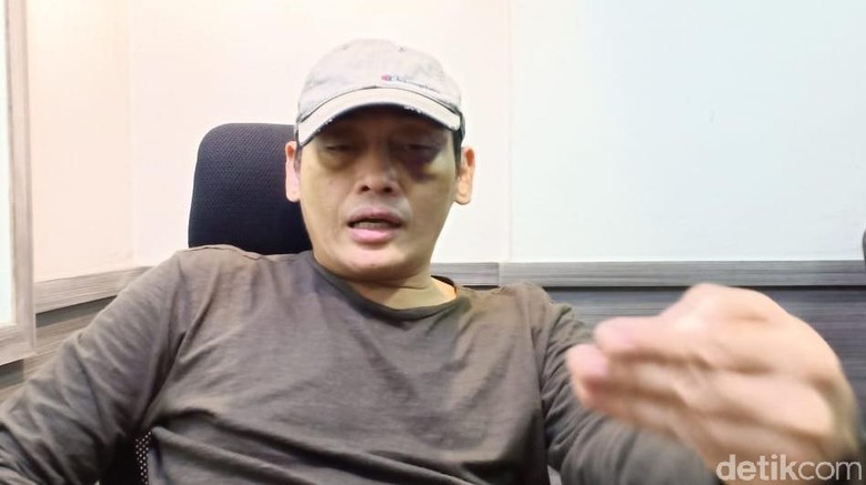 Ninoy Minta DKM Al Falah Klarifikasi Pernyataan Tak Ada Pemukulan di Masjid